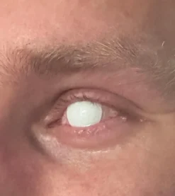 Crazylinser Blind White